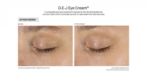 EJ_Eye-Website-Before_and_Afters