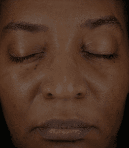 Journee-Firm-After-