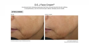 DEJ face cream before & after