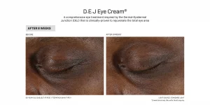 DEJ eye cream before & after 