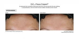 DEJ face cream before & after
